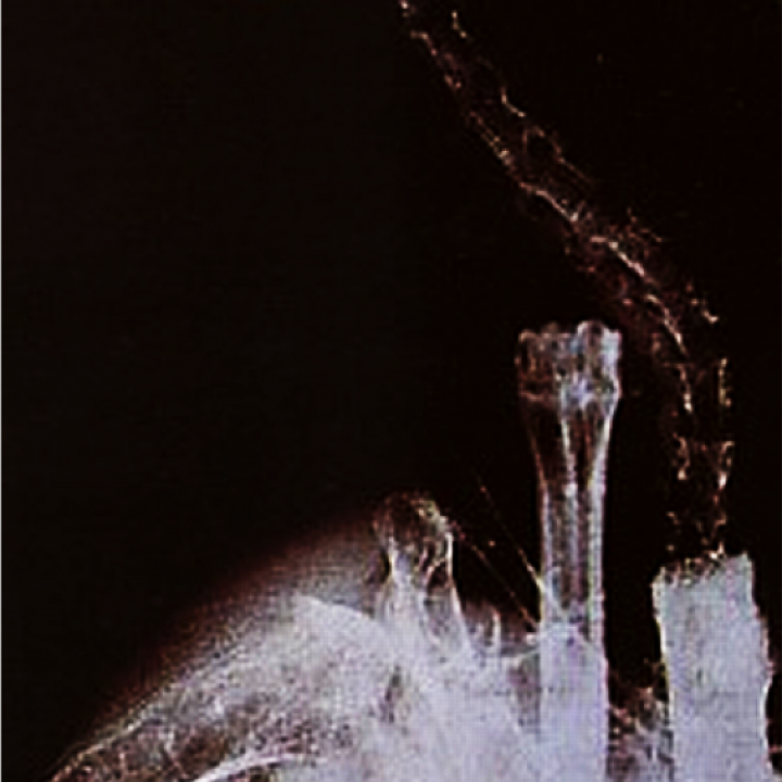 Röntgen-Bild eines Bartgeiers: Der verschluckte Knochen füllt den Magen und einen Teil der Speiseröhre